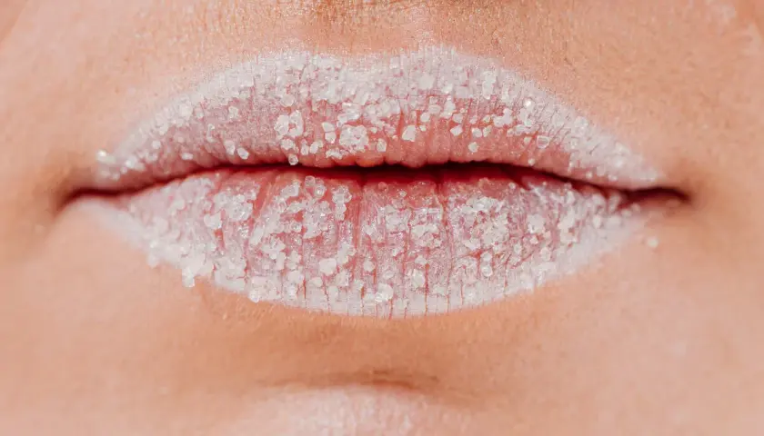 Labios blancos cubiertos de azúcar, posibles causas de sequedad y descamación.