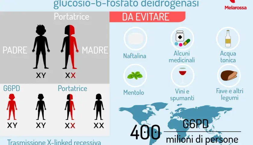 Il favismo, o carenza di G6PD, è una condizione genetica. L'infografica mostra cosa evitare: naftalina, alcuni medicinali, acqua tonica, mentolo, vini e fave.
