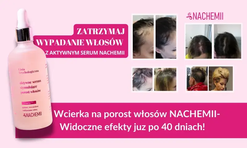 Wcierki do włosów: Czy działają? Składniki, efekty i jak stosować