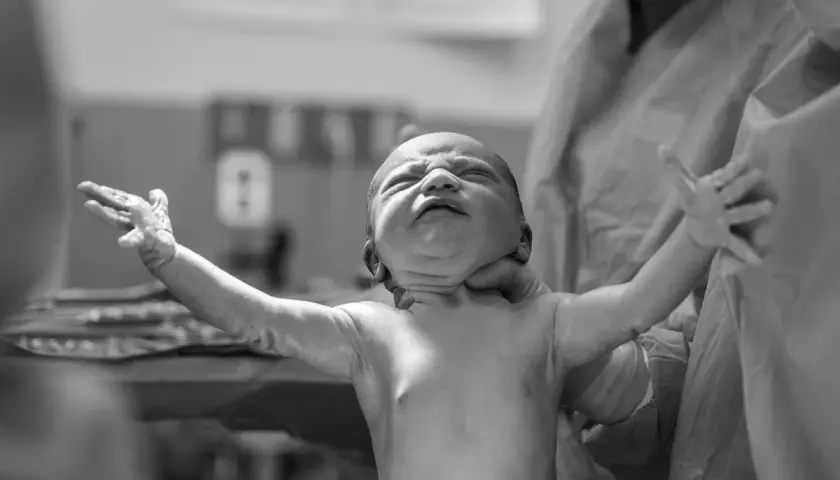 Neonato con movimenti a scatti delle braccia, appena nato, con espressione intensa e occhi chiusi.