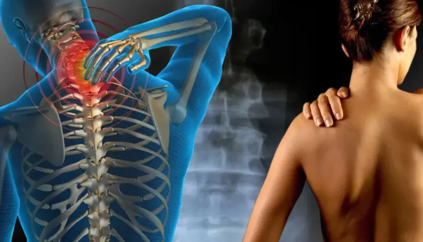 Anatomía humana con columna vertebral resaltada en rojo, sugiriendo dolor. Una mujer se toca el hombro. Podría ser una representación de la distrofia muscular.