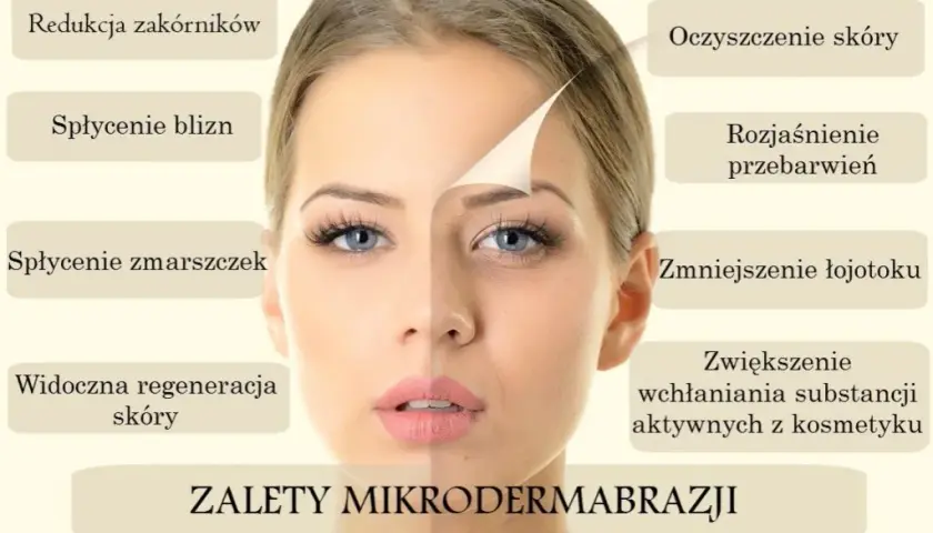 Mikrodermabrazja twarzy: Czy to klucz do Twojej idealnej cery?