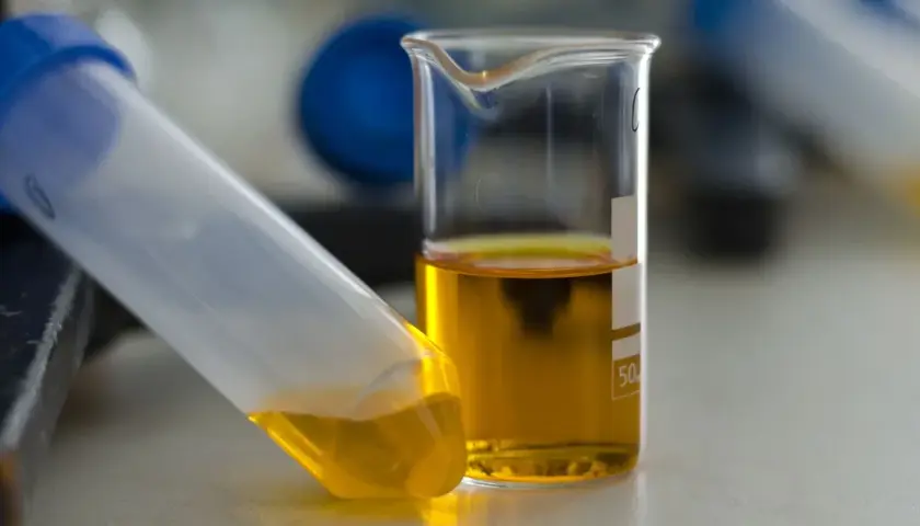 Jak przechowywać mocz przed oddaniem do laboratorium, by uniknąć błędów?