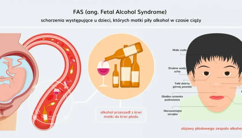 Ilustracja pokazuje płód w łonie matki, butelki alkoholu i dziecko z cechami FAS. Alkohol przechodzi z krwi matki do krwi płodu, powodując alkoholowy zespół płodowy.