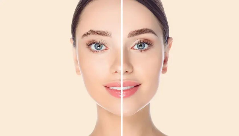 Comparación de cejas: antes, con microblading mal hecho, y después, con cejas perfectas.