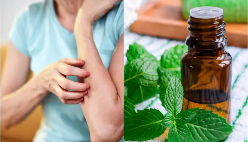 Persona con picazón en el brazo, junto a aceite esencial de menta. Posibles remedios caseros para la alergia a la humedad.