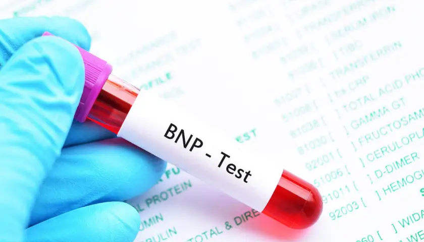 Blauer Handschuh hält Blutprobe für BNP-Test. Laborbericht im Hintergrund zeigt verschiedene Werte, darunter den BNP Wert.