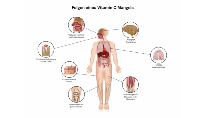 Vitaminmangel Symptome: Erkennen Sie die Warnsignale Ihres Körpers