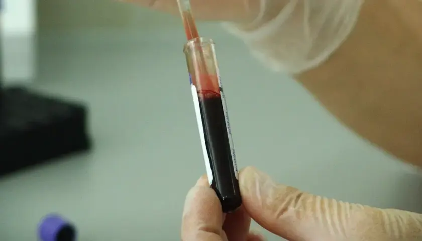 Czy leki na HIV są refundowane? Sprawdź, co musisz wiedzieć o dostępności