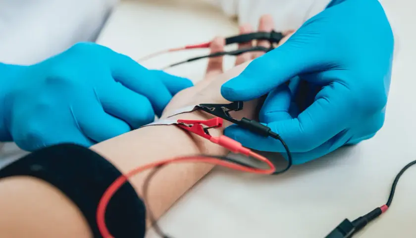 Badanie EMG, czyli elektromiografia, to badanie oceniające funkcję nerwów i mięśni. Na zdjęciu widać elektrody podłączone do ręki pacjenta.