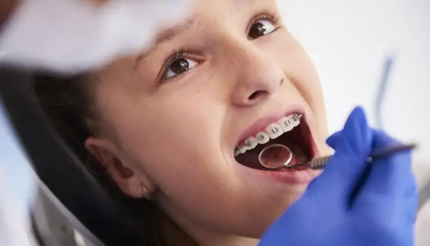 Ortodonta czy dentysta? Kto założy aparat na zęby?