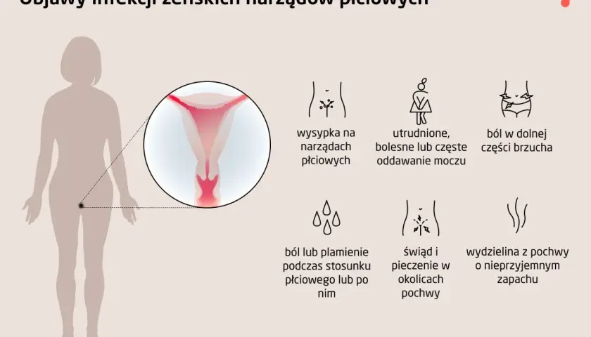 Objawy infekcji intymnej: wysypka, ból brzucha, pieczenie, wydzielina z pochwy. Ilustracja przedstawia objawy infekcji żeńskich narządów płciowych.
