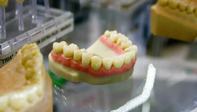 Modello di dentiera mobile con denti bianchi e gengive rosa su un piano di vetro.