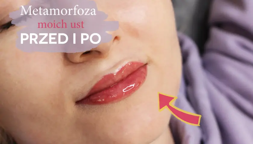 Metamorfoza moich ust przed i po. Efekt pięknych, pełnych ust dzięki makijażowi permanentnemu.