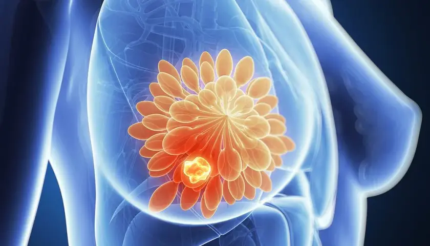 Skutki uboczne herceptyny – co musisz wiedzieć o działaniach niepożądanych