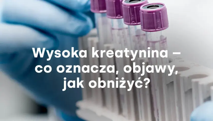 Rękawiczka laboratoryjna trzyma probówki. Tekst: "Wysoka kreatynina – co oznacza, objawy, jak obniżyć?".