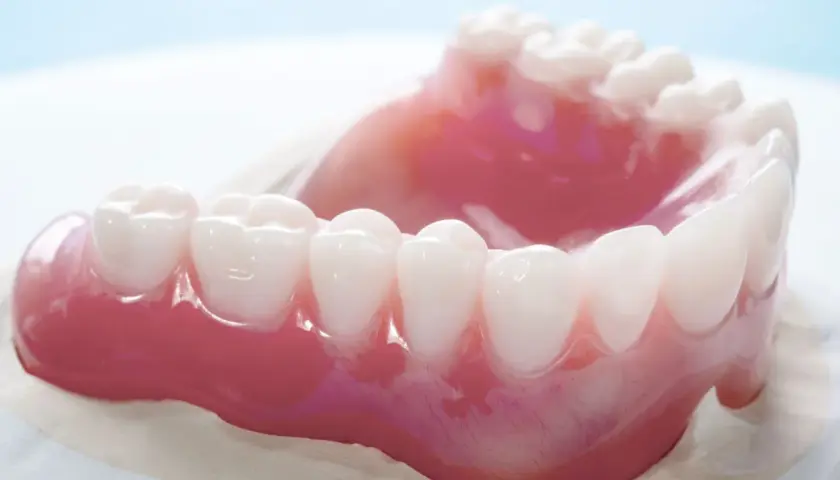 Modello di diversi tipi di protesi dentarie, con denti bianchi e gengive rosa realistiche.