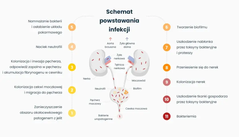 Schemat infekcji dróg moczowych: od zanieczyszczenia jelitowego, przez kolonizację pęcherza, po uszkodzenie nerek i bakteriemię. Ból pęcherza od jelit to początek problemu.
