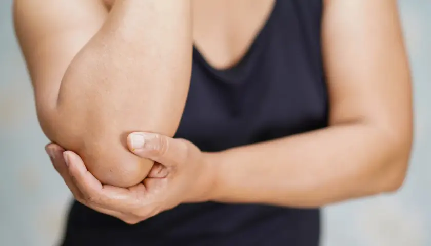 Dłoń obejmuje łokieć, który może być poddawany testowi cozena.
