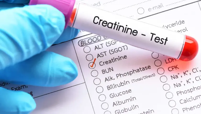Rękawiczka w niebieskiej rękawiczce trzyma probówkę z napisem "Creatinine - Test". Obok zaznaczono "Creatinine" na formularzu badań. Sprawdź, jaka jest kreatynina cena.