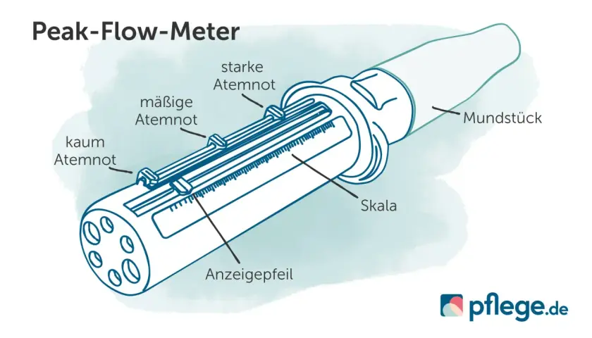Detailansicht eines Peak-Flow-Meters mit Skala und Anzeige. Es zeigt, wieviel GDB bei COPD GOLD 3 gemessen werden kann.