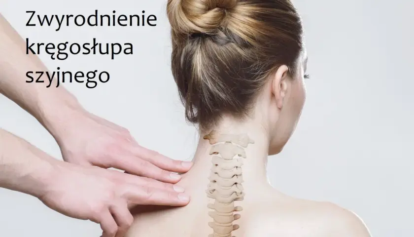 Dłonie masują kark kobiety, wskazując na zwyrodnienie kręgosłupa szyjnego. Szukaj leków na zwyrodnienie kręgosłupa szyjnego.