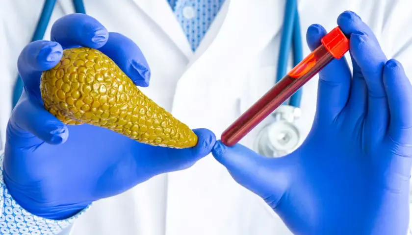 Lekarz w niebieskich rękawiczkach trzyma model trzustki i probówkę z krwią. Badanie amylazy co to jest, może pomóc w diagnostyce.