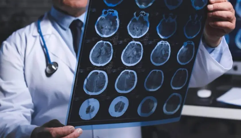 Neurolog od czego zacząć? Objawy, które mogą zaskoczyć