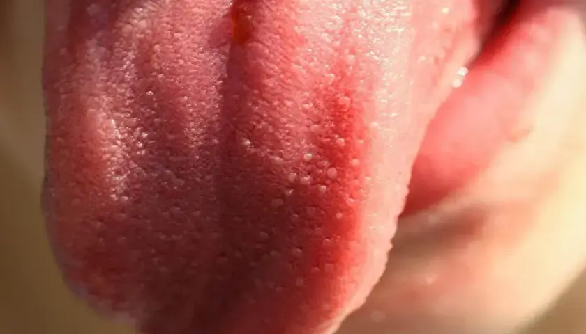 Lingua rosa con piccole macchie biancastre, forse papille gustative irritate o piccole afte.