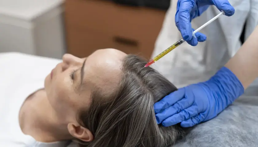 Una mano enguantada inyecta líquido en el cuero cabelludo de una mujer. Podría aliviar el dolor o estimular el crecimiento del cabello.