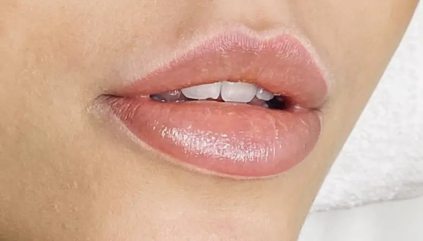 Fylliga läppar med en naturlig rosa ton efter lip blush-behandling. Vackert och fräscht resultat.