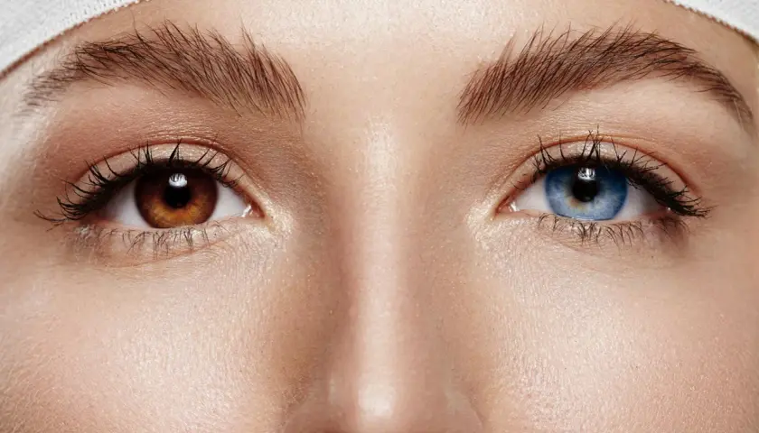 Oczy z **heterochromią centralną**: jedno brązowe, drugie niebieskie. Wokół nich delikatna skóra i podkreślone rzęsy.