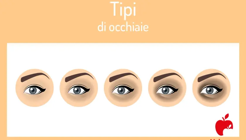 Cinque tipi di occhiaie nere, da leggere a profonde, illustrate con occhi stilizzati.