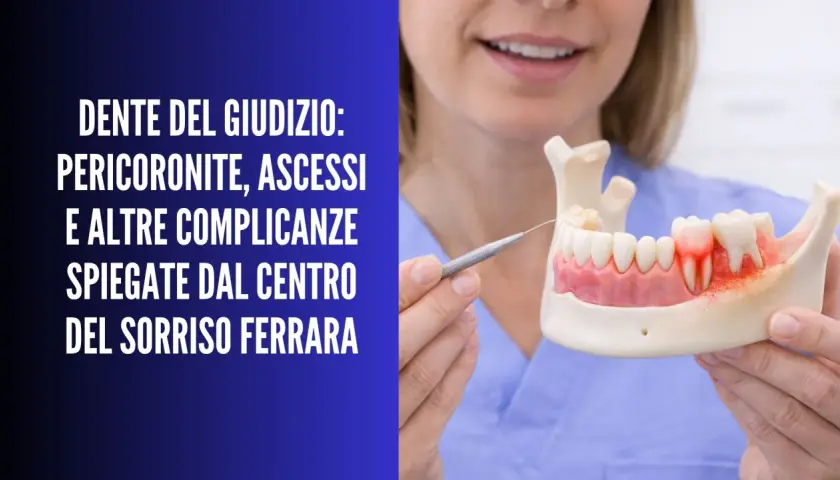 Modello di mascella con dente del giudizio infiammato, che illustra il dolore alla pressione. Dentista spiega complicazioni.