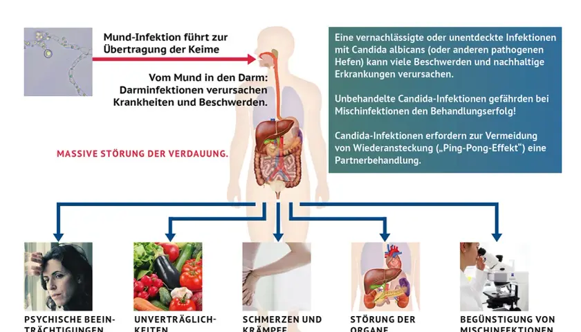 Psychische Belastung, Verdauungsprobleme, Schmerzen, Organstörungen und Mischinfektionen sind Symptome, wenn Candida abstirbt.