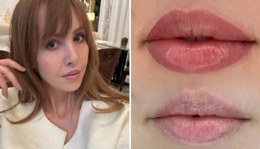 Kvinna med ljus hy och brunt hår. Närbild på läppar före och efter lip blush-behandling.