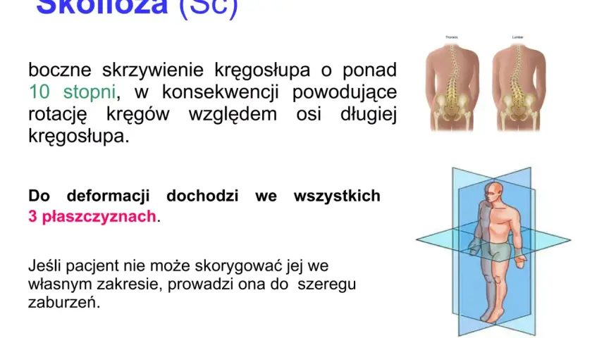 Skolioza (Sc) to boczne skrzywienie kręgosłupa. Test rissera ocenia dojrzałość kostną, pomocną w prognozowaniu progresji skoliozy.