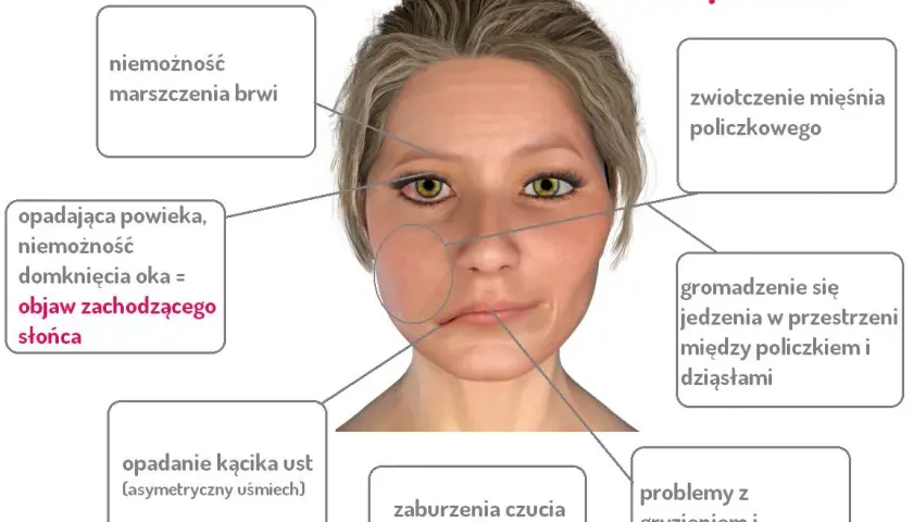 Ból twarzy i dziąseł po przewianiu? Poznaj objawy i skuteczne leczenie