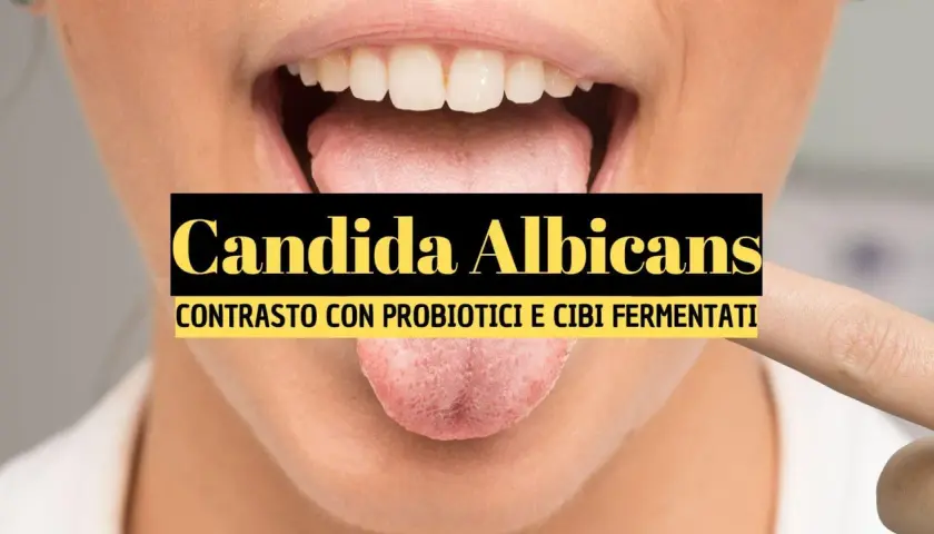 Lingua con candida orale. Contrasto con probiotici e cibi fermentati per combattere la candidosi.