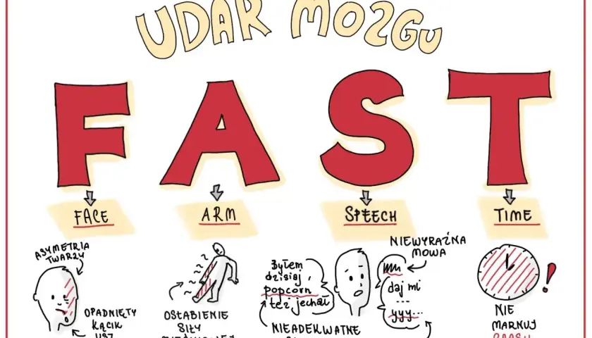 Objawy udaru mózgu: FAST. Asymetria twarzy, osłabienie siły mięśniowej, nieadekwatne słowa, braki w słowach, niewyraźna mowa, nie marnuj czasu. Czasownik to czynność, np. "daj mi".