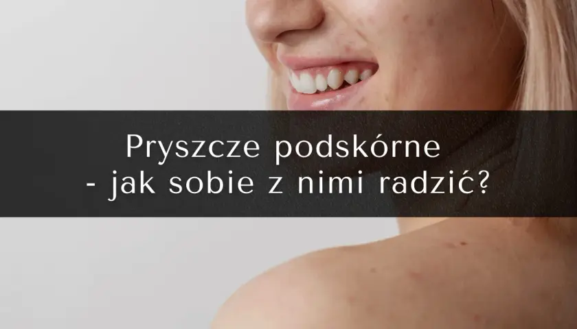 Podskórne pryszcze: Jak się ich pozbyć? Skuteczny plan ekspertki