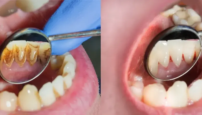 Jak zwracać się do dentysty, aby zyskać jego szacunek i zaufanie