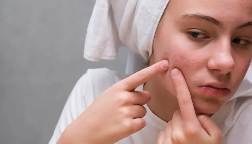 Pryszcz przed ważnym wyjściem? Pozbądź się go w kilka godzin!