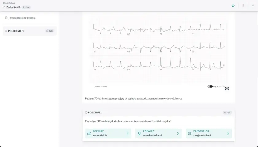 EKG pacjenta z niewydolnością serca. Interaktywny kurs EKG online pomaga analizować zapisy.