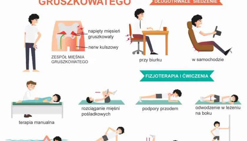 Ilustracja pokazuje zespół mięśnia gruszkowatego, jego objawy i ćwiczenia fizjoterapeutyczne, takie jak rozciąganie, podpory i pływanie.