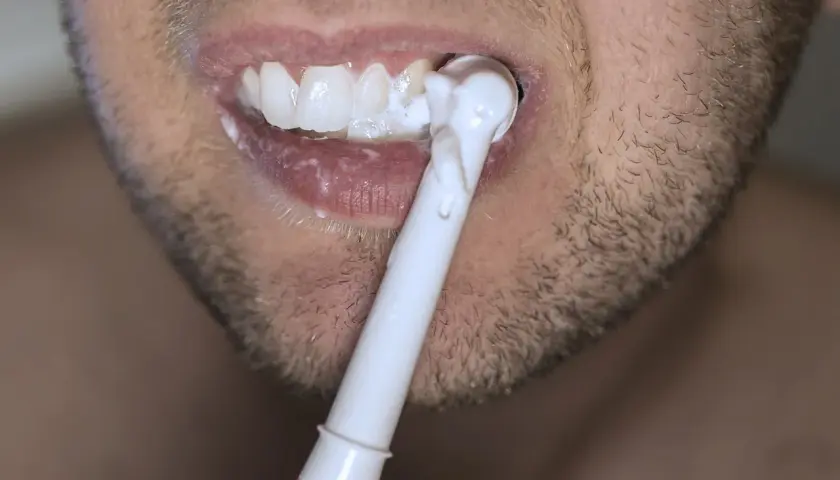 Bocca con denti bianchi e spazzolino elettrico. Nonostante la cura, la carie è una preoccupazione.