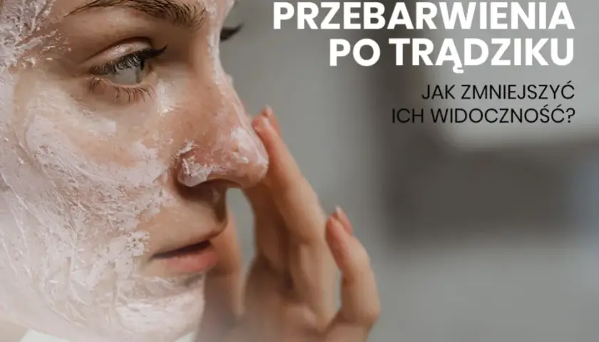 Jak pozbyć się blizn po pryszczach? Domowe i profesjonalne metody