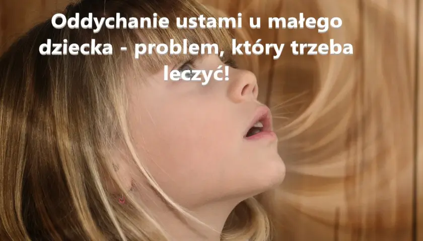 Dziecko z otwartymi ustami, sugerujące oddychanie przez usta. To problem, który wymaga uwagi i leczenia.