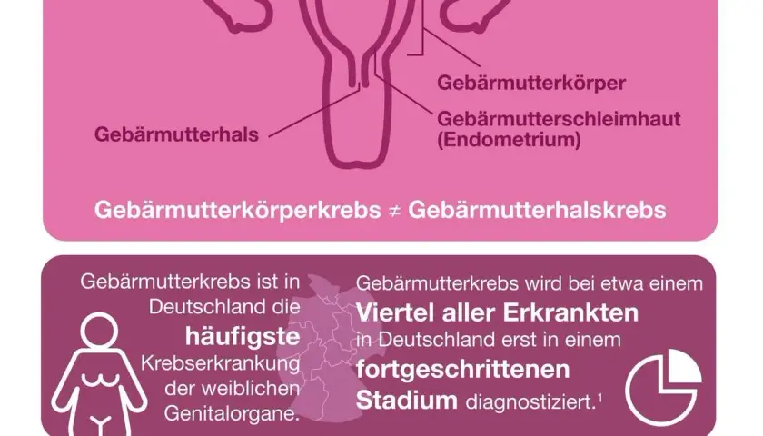 Symptome bei Gebärmutterkrebs: Warnzeichen, die Sie nicht ignorieren sollten