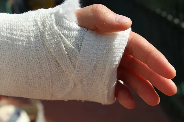 Sennik złamana ręka u kogoś: Co zwiastuje ten niepokojący symbol w śnie